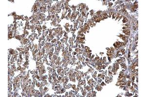Immunohistochemistry (IHC) image for anti-Protein Disulfide Isomerase Family A, Member 3 (PDIA3) (C-Term) antibody (ABIN2854699)
