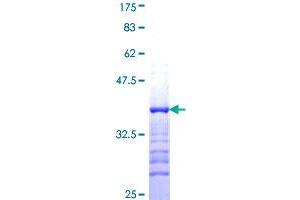 SPR Protein (AA 164-260) (GST tag)