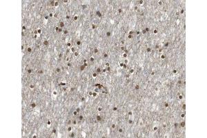 ABIN6266531 at 1/100 staining human brain tissue sections by IHC-P. (E2F4 antibody)
