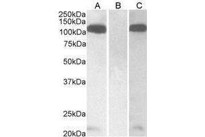 Western Blotting (WB) image for anti-Furin (Paired Basic Amino Acid Cleaving Enzyme) (FURIN) (C-Term) antibody (ABIN2473713) (FURIN antibody  (C-Term))