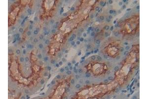 Detection of MEP1a in Human Kidney Tissue using Polyclonal Antibody to Meprin A Alpha (MEP1a) (MEP1A antibody  (AA 213-506))
