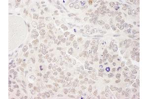 Immunohistochemistry (IHC) image for anti-Superkiller Viralicidic Activity 2-Like 2 (SKIV2L2) (AA 100-150) antibody (ABIN7448797)