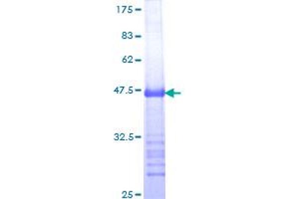 MDM4-binding Protein Protein (AA 381-490) (GST tag)