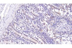 Detection of MUC5B in Human Small intestine Tissue using Monoclonal Antibody to Mucin 5 Subtype B (MUC5B) (MUC5B antibody  (AA 5653-5762))