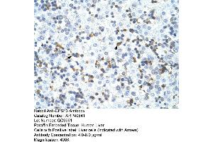 Rabbit Anti-CPSF3 Antibody  Paraffin Embedded Tissue: Human Liver Cellular Data: Liver cells Antibody Concentration: 4.