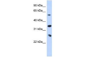 WB Suggested Anti-UBE2K Antibody Titration:  0. (UBE2K antibody  (Middle Region))
