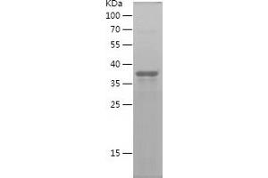 Western Blotting (WB) image for Secreted Frizzled-Related Protein 2 (SFRP2) (AA 25-171) protein (His-IF2DI Tag) (ABIN7283226) (SFRP2 Protein (AA 25-171) (His-IF2DI Tag))