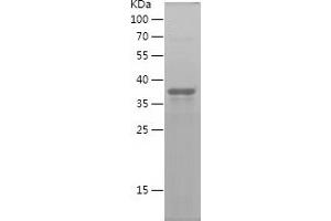 Western Blotting (WB) image for Secreted Frizzled-Related Protein 2 (SFRP2) (AA 25-171) protein (His-IF2DI Tag) (ABIN7283225) (SFRP2 Protein (AA 25-171) (His-IF2DI Tag))