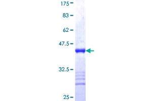 IGF2BP2 Protein (AA 65-169) (GST tag)