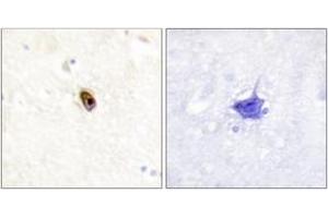 Immunohistochemistry analysis of paraffin-embedded human brain, using AurB/C (Phospho-Thr236/202) Antibody. (AurB/C antibody  (pThr236))