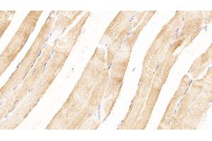 Detection of MYOG in Rat Skeletal muscle Tissue using Polyclonal Antibody to Myogenin (MYOG) (Myogenin antibody  (AA 4-219))