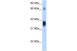 NOV antibody used at 1. (NOV antibody  (Middle Region))