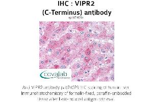 Image no. 1 for anti-Vasoactive Intestinal Peptide Receptor 2 (VIPR2) (C-Term) antibody (ABIN1740724) (VIPR2 antibody  (C-Term))