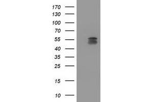 HEK293T cells were transfected with the pCMV6-ENTRY control (Left lane) or pCMV6-ENTRY CYP2C9 (Right lane) cDNA for 48 hrs and lysed. (CYP2C9 antibody)