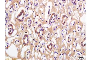Formalin-fixed and paraffin embedded human kidney labeled with Rabbit Anti Phospho-Beta Catenin (Thr41/Ser45) Polyclonal Antibody, Unconjugated (ABIN683953) at 1:200 followed by conjugation to the secondary antibody and DAB staining (beta Catenin antibody  (pSer45, pThr41))