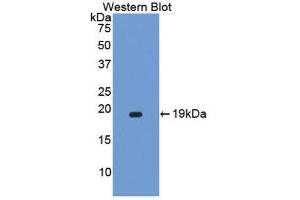 Western Blotting (WB) image for anti-Corin, Serine Peptidase (CORIN) (AA 448-579) antibody (ABIN1858499) (Corin antibody  (AA 448-579))