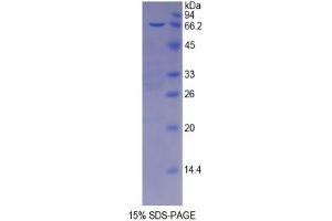 SDS-PAGE analysis of Mouse Protease, Serine 8 Protein. (Protease Protein)