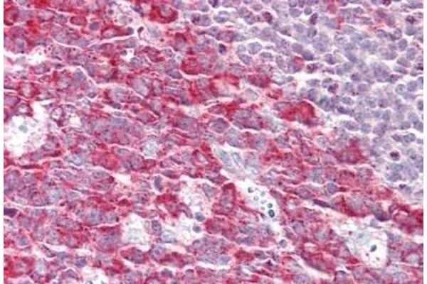 Formin-Like 1 antibody  (C-Term)