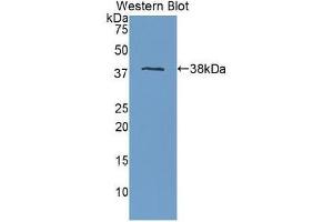 Detection of Recombinant APOH, Human using Polyclonal Antibody to Apolipoprotein H (APOH) (APOH antibody  (AA 22-345))