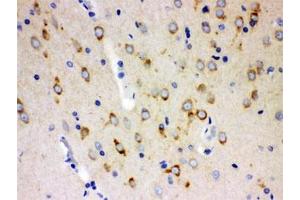 IHC testing of FFPE rat brain with SSH3BP1 antibody. (ABI1 antibody)