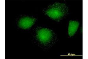 Immunofluorescence of purified MaxPab antibody to HIP1R on HeLa cell.