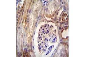 Formalin fixed, paraffin embedded human kidney tissue reacted with DYNLRB2 Antibody  followed by peroxidase conjugation of the secondary antibody and DAB staining. (DYNLRB2 antibody  (Middle Region))