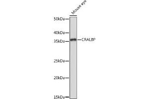 Western blot analysis of extracts of Mouse eye, using CRALBP Rabbit mAb (ABIN7269934) at 1:1000 dilution. (RLBP1 antibody)