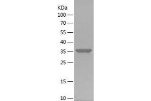 Western Blotting (WB) image for Integrin beta 5 (ITGB5) (AA 71-201) protein (His-IF2DI Tag) (ABIN7282309) (Integrin beta 5 Protein (ITGB5) (AA 71-201) (His-IF2DI Tag))