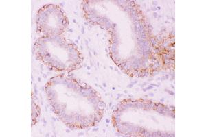 Anti-CTNNA1 Picoband antibody,  IHC(P): Human Mammary Tissue (CTNNA1 antibody  (AA 143-292))