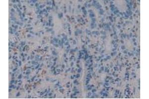 IHC-P analysis of Human Stomach Tissue, with DAB staining. (Iba1 antibody  (AA 1-147))