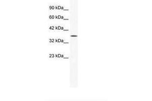 Image no. 2 for anti-Y Box Binding Protein 2 (YBX2) (AA 178-227) antibody (ABIN202349) (YBX2 antibody  (AA 178-227))