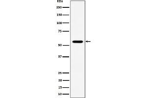 Western blot analysis of RNF14 expression in Jurkat cell lysate.