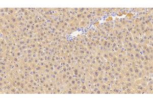 Detection of CGRP in Mouse Liver Tissue using Polyclonal Antibody to Calcitonin Gene Related Peptide (CGRP) (CGRP antibody  (AA 1-130))