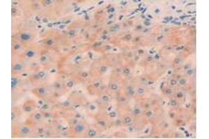 Figure. (Cyclin D2 antibody  (AA 68-278))