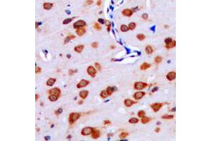 Immunohistochemical analysis of IPPK staining in human brain formalin fixed paraffin embedded tissue section. (IPPK antibody  (N-Term))