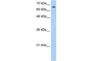 SYVN1 antibody used at 1. (SYVN1 antibody  (Middle Region))