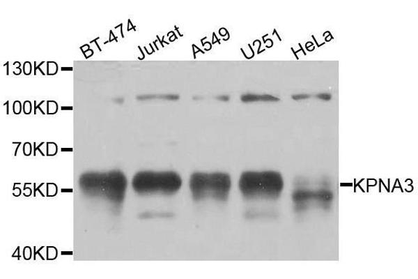 KPNA3 antibody  (AA 1-210)