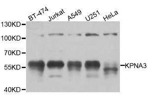 Western blot analysis of extracts of various cell lines, using KPNA3 antibody.