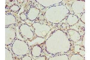 Immunohistochemistry of paraffin-embedded human thyroid tissue using ABIN7148776 at dilution of 1:100 (CMC4 antibody  (AA 1-68))