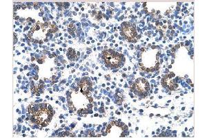 Paraffin-embedded human lung. (Glucuronidase beta antibody  (C-Term))