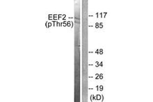 Western blot analysis of extracts from NIH-3T3 cells treated with Serum 10% 30', using eEF2 (Phospho-Thr56) Antibody. (EEF2 antibody  (pThr56))