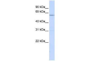 LRRC15 antibody used at 1 ug/ml to detect target protein. (LRRC15 antibody  (N-Term))