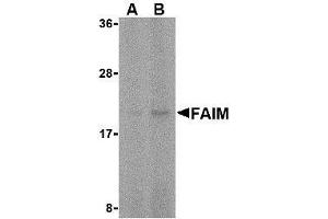 Western blot analysis of FAIM in human spleen tissue lysate with AP30328PU-N FAIM antibody at (A) 5 and (B) 10 μg/ml.