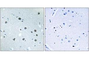 Immunohistochemistry (IHC) image for anti-Myosin ID (MYO1D) (AA 825-874) antibody (ABIN2890431) (Myosin ID antibody  (AA 825-874))