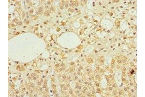 Immunohistochemistry of paraffin-embedded human adrenal gland tissue using ABIN7143883 at dilution of 1:100