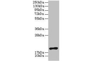 Western blot All lanes: NR2C2AP antibody at 4 μg/mL + HL60 whole cell lysate Secondary Goat polyclonal to rabbit IgG at 1/10000 dilution Predicted band size: 16, 20 kDa Observed band size: 20 kDa