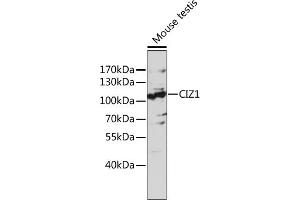 Western blot analysis of extracts of mouse testis, using CIZ1 antibody (ABIN7266237) at 1:1000 dilution. (CIZ1 antibody  (AA 250-440))