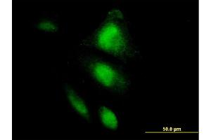Immunofluorescence of monoclonal antibody to HSPA2 on HepG2 cell. (HSPA2 antibody  (AA 1-639))