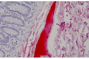 Human Blood Plasma: Formalin-Fixed, Paraffin-Embedded (FFPE) (Complement Factor H antibody)