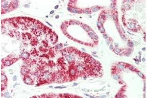 Human, Kidney: Formalin-Fixed Paraffin-Embedded (FFPE) (HADH antibody  (C-Term))